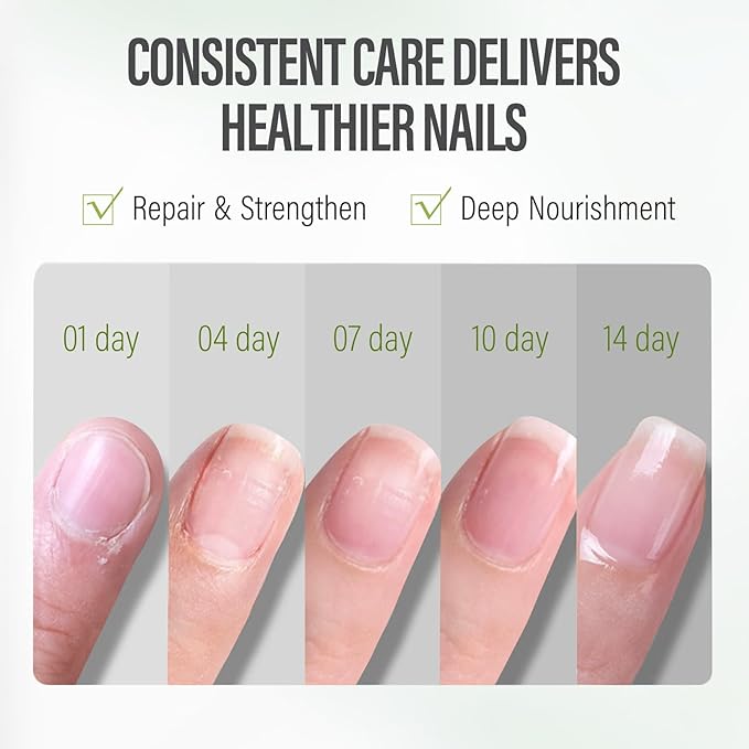 CHUCHU Nail Growth and Strengthener Oil for Cuticle - Repair Moisturizing Treatment - Natural Jojoba Vitamin B & E Nail Oil for Dry Cracked Nails (Aloe Vera)