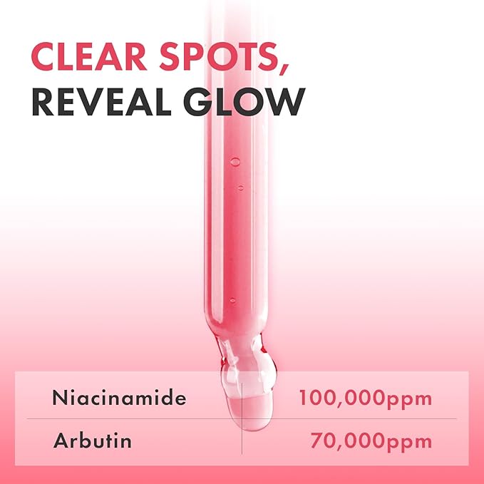 TOSOWOONG Niacinamide 10% Arbutin 7% Serum, Hyperpigmentation, Dark Spot Remover, Discoloration Correcting for Uneven Skin Tone, Glass Skin, All Skin Types, Korean Skincare, 33ml / 1.11 fl. oz.