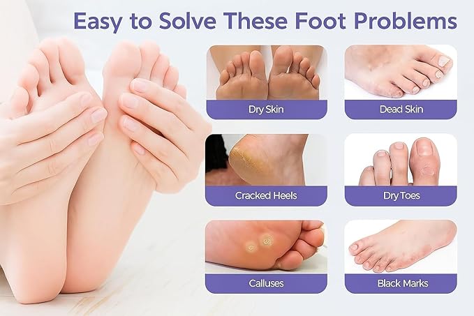 Goat Milk Foot Peel Mask (6 Pack), Exfoliating Foot Mask for Dry Cracked Feet, Dead Skin Callus Remover, Foot Exfoliator for Baby Soft Feet (Goat Milk)