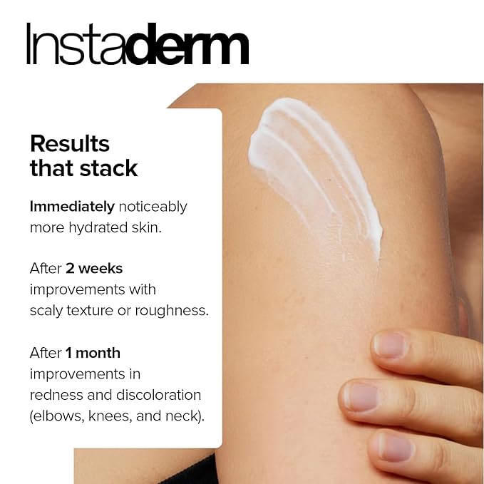 Keratosis Pilaris Treatment- KP Bump Eraser. Smoothing Exfoliating Moisturizing Lotion for Rough, Dry, Flakey & Bumpy Skin Conditions with Lactic Acid, AHA. Smooth Skin Body Cream.