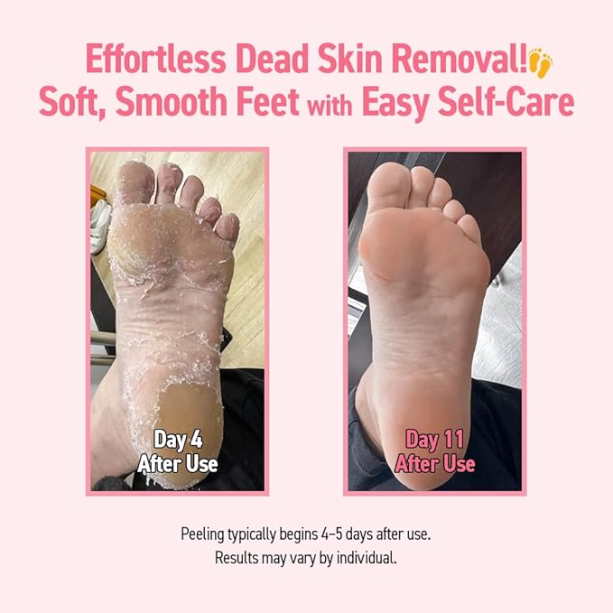 Exfoliating Foot Peel Mask with AHA/BHA & 4 Fruit Extracts – Removes Dead Skin & Calluses for Baby Soft Feet – Foot Peeling Mask Socks for Dry, Cracked Feet (2 Pairs)