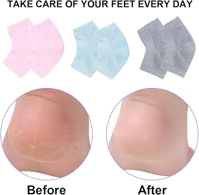 Vented Moisturizing Gel Heel Socks, 3 Pairs Toeless Spa Sock for Foot Care Treatment, Cracked Heels, Dry Feet, Foot Calluses (Gray, Green, Pink)