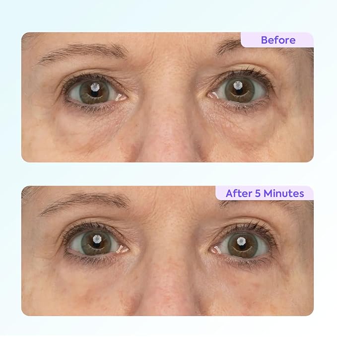 WEERSHUN Instant Lift Eye Gel – Reduces the Look of Eye Bags, Instant Firm Eye Tightener, Wrinkle Smoothing, Firming Hydrating Care for Under-Eye Bags, Crow’s Feet & Dark Circles (10ml*2)