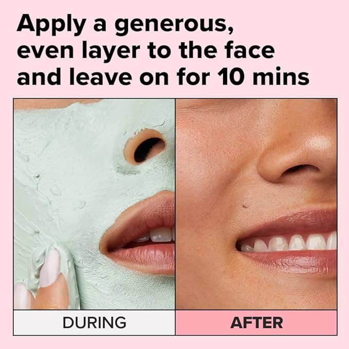 I DEW CARE Heartleaf Clay Mask - Yoga Kitten | Wash-off, For Blemish-prone with Kaolin, Heartleaf, Tea Tree Extract, Home Spa, Korean Skincare, Glass Skin Look, Soothing, Christmas Gifts, 2.5 FL Oz