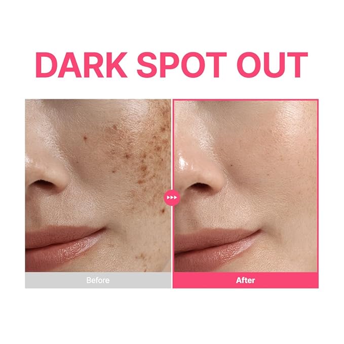 PURITO TXA 6% + Niacinamide 10% Facial Serum | for Dark Spots, Hyperpigmentation, Uneven Skin Tone | High-Concentration Tranexamic Acid | Korean Skincare, 30mL 1.01 fl.oz