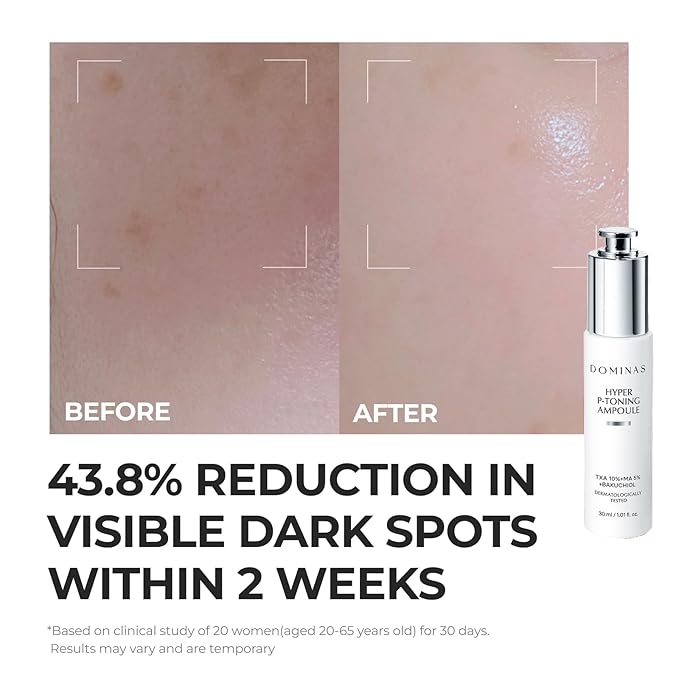 DOMINAS 10% Tranexamic Acid Serum (Hyper P-Toning) - Discoloration Correcting & Turnover Booster Brightening Serum with TXA, 5% AHA, 5% Niacinamide, Dark Spots, Pore Care, Korean Skincare, 1.01 fl oz