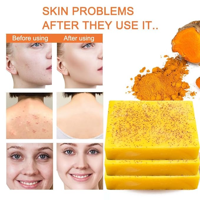 Turmeric Bar Soap & Turmeric Orange Vitamin C Body Wash with Cocoa Seed Exfoliant, Mattifying Scrub for Uneven Skin Texture, Body-Only Daily Use