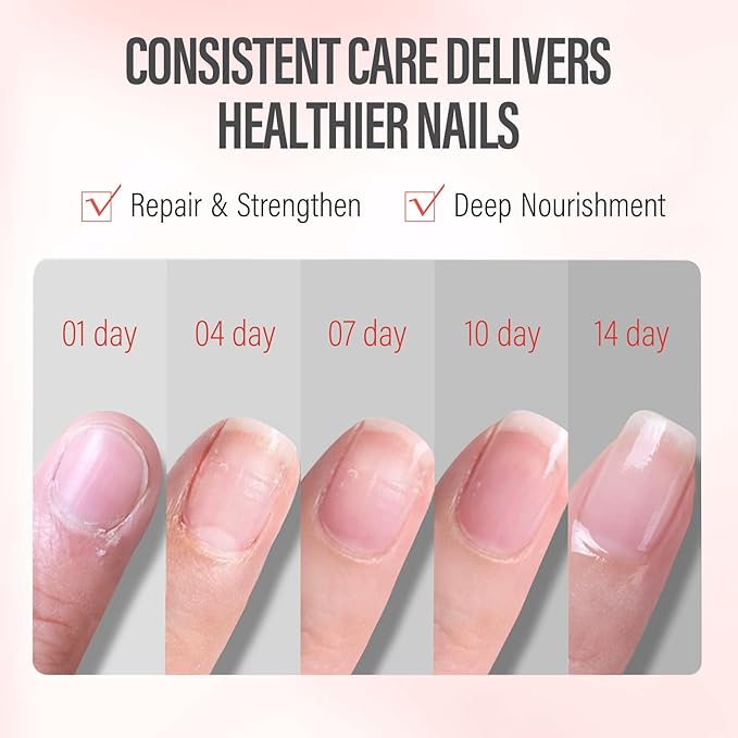 CHUCHU Vegan Cuticle Oil for Nails: Pomegranate Jojoba Nail Cuticle Oil with Vitamin B & E for Moisturizes Cuticle and Nail's Skin - Prevents Hangnails and Chapped 15ML