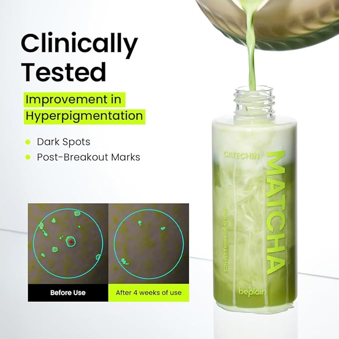 beplain Matcha Catechin Skin Purifying Essence for Face | Hydrating & Balancing Facial Essence for Glowy, Healthy Skin | Suitable for Sensitive Skin | K-Beauty (5.07 fl oz / 150 ml)