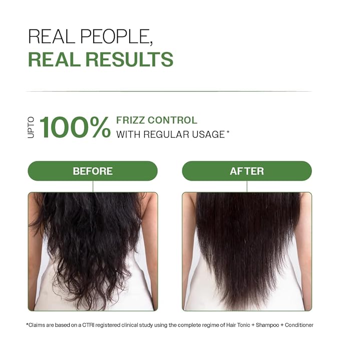 Bare Anatomy Anti-Dandruff Hair Conditioner with Biotin, Salicylic Acid & Rosemary | Removes Flaky Buildup | Moisturizes & Strengthens Hair | Reduces Frizz & Breakage | For All Hair Types | 175gm
