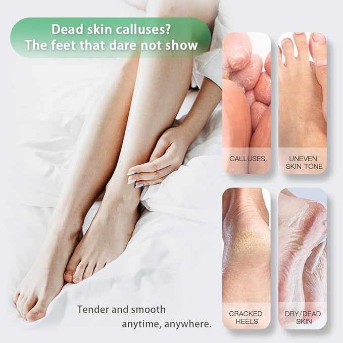 Dr.Pedi Foot Peeling Mask Exfoliating Foot Masks for Dry Dead Skin and Calluses Removal Aloe Vera Foot Spa Treatment for Soft Smooth Feet (5 Pairs)