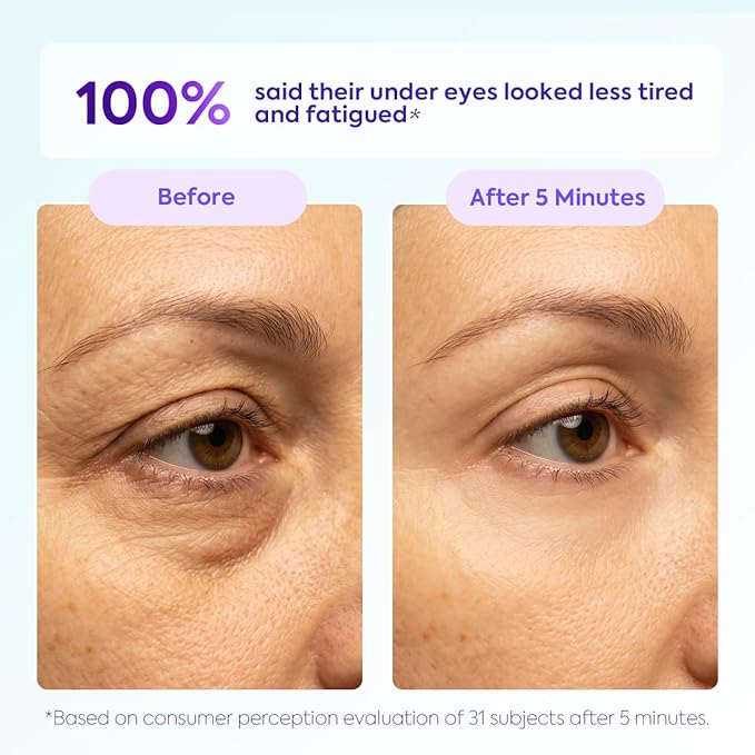 WEERSHUN Instant Lift Eye Gel – Reduces the Look of Eye Bags, Instant Firm Eye Tightener, Wrinkle Smoothing, Firming Hydrating Care for Under-Eye Bags, Crow’s Feet & Dark Circles (10ml)