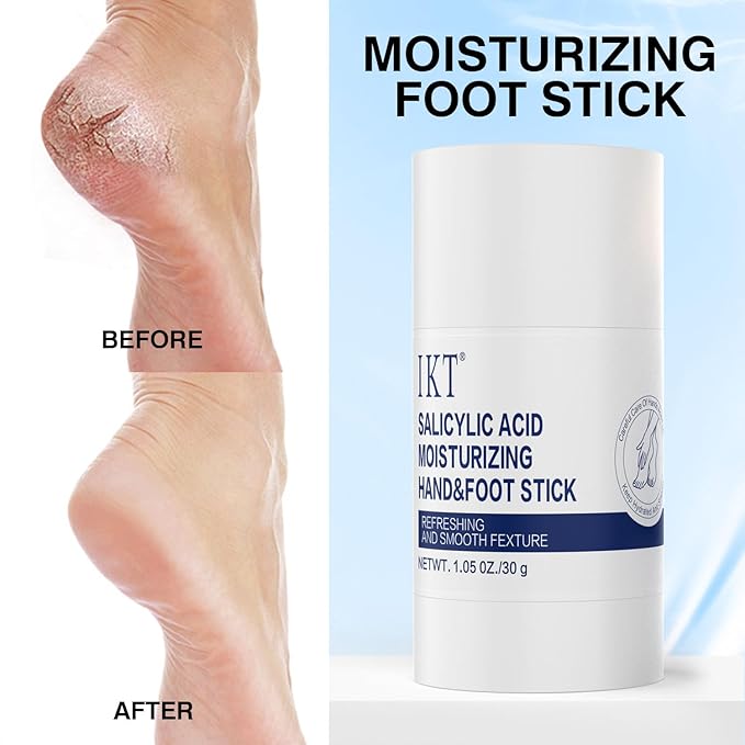 Heel Crack Care & Moisturizing Set, Includes a pair of moisturizing heel socks and a professional heel repair stick. deeply treats dry and cracked feet