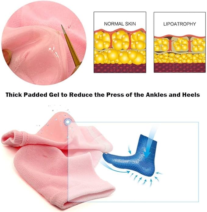 Codream Vented Moisturizing Socks Lotion Gel for Dry Cracked Heels, Spa Gel Socks Humectant Moisturizer Heel Balm Foot Treatment Care Heel Softener Compression (2 Pairs)