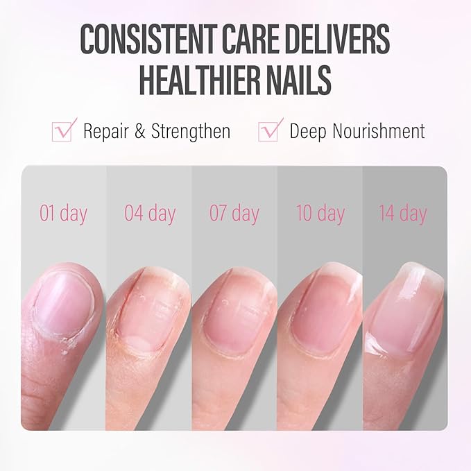 CHUCHU Vegan Cuticle Oil for Nails: Peach Jojoba Nail Cuticle Oil with Vitamin B & E for Moisturizes Cuticle and Nail's Skin - Prevents Hangnails and Chapped 15ML