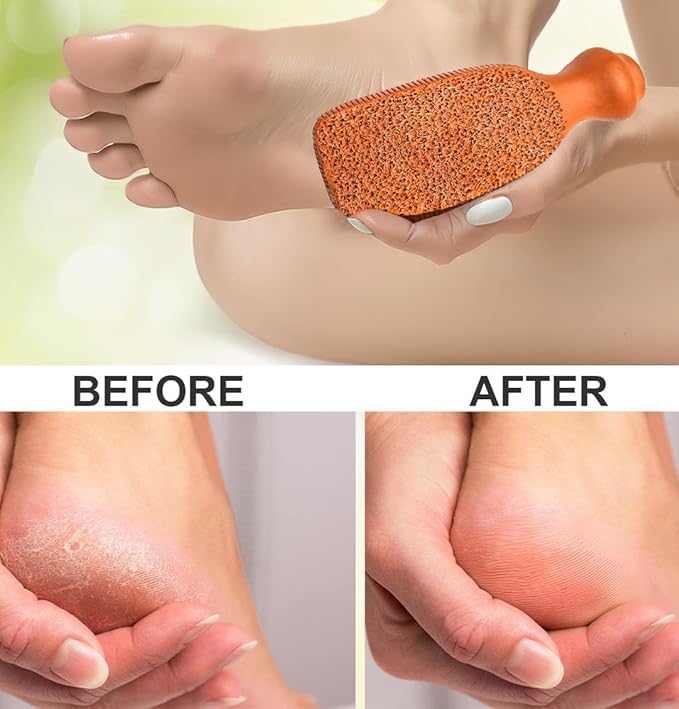 QUBA LINEN Pumice Stone for Feet – 2-Sided Terra Cotta Foot Scrubber, Natural Callus Remover for Dry Skin & Rough Heels, Cracked Heels – Pedicure Exfoliator for Feet Hands Body