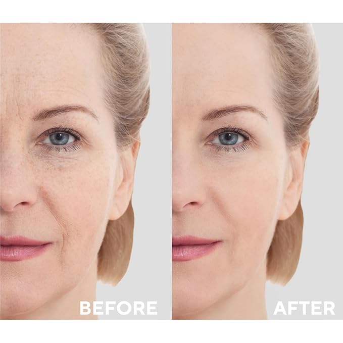 The Ceel Retinol Serum for Face | Resurfacing Retinol Serum | Firming, Anti aging, Brightening | Smoothing Fine Lines and Wrinkles | Retinol 1%, Ceramides and Niacinamide|1 fl.oz(30 ML)