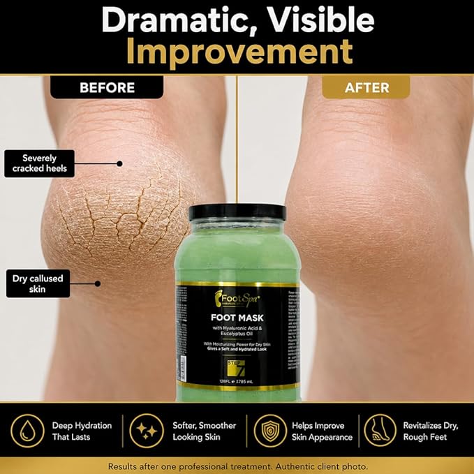 Professional Pedicure Treatment - Medical-Grade Dermal Recovery Mask with Luxury Actives at Industrial Scale, Repairs Skin Barrier for Instant Wow Softness, 128 Oz / 1 Gallon
