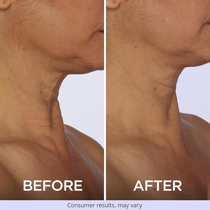 goPure Tighten & Lift Neck & Chest Moisturizer Cream for Visibly Firming, Tightening and Lifting the Look of Wrinkles & Crepey Skin, 1.7oz - Pack of 2