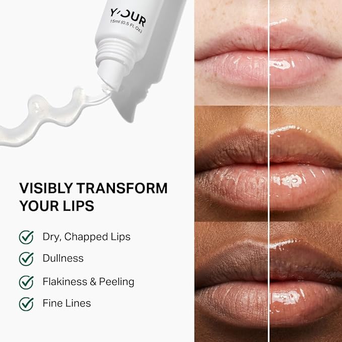 Y’OUR Intensive Healing Lip Balm for Dry Chapped Lips - Deeply Hydrating Lip Treatment - Hyaluronic Acid, Shea Butter & Rosehip Oil - Repairing Moisturizer, Paraben & Silicon-Free, Mothers' Day Gift