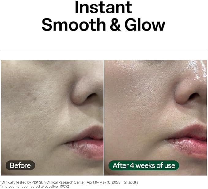 Dr. G Black Snail Retinol Ampoule - Korean Skincare with Snail Mucin - Advanced Retinol Face Ampoule for Glowing Skin - Anti Aging - Pore Minimizer for Fine Lines & Even Skin Tone Support - 1.69 fl oz