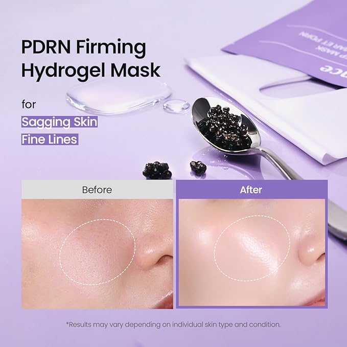 BIODANCE Rejuvenating Caviar PDRN Real Deep Mask, Overnight Hydrogel Face Mask, Skin Firming, Radiance, Enhancing Skin Recovery, Korean Skin Care, Mothers Day Gifts | 1.19oz(34g) x 4ea