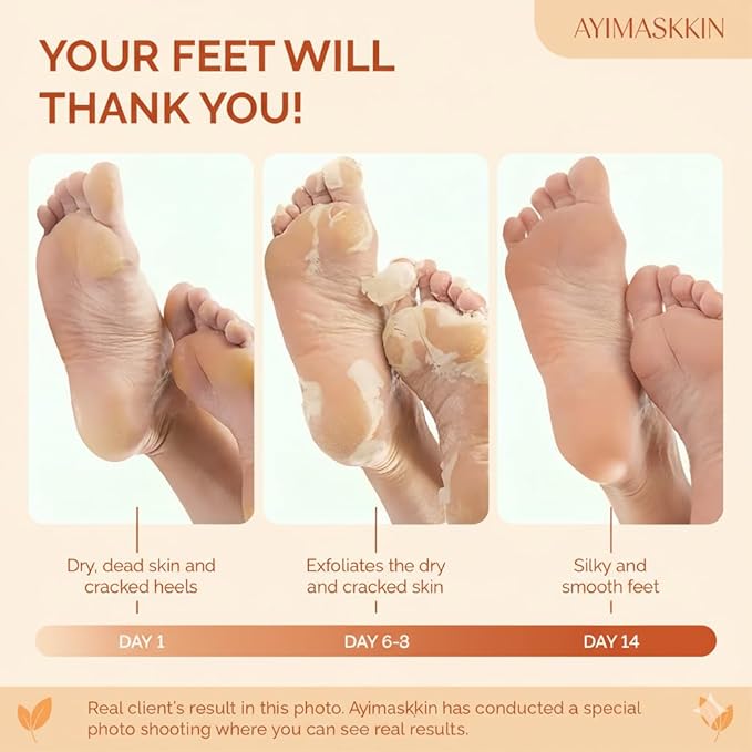 Peeling Foot Mask 3 Pack | Lavender Extract Foot Peel for Dead Skin Removal & Heel Repair | Dermatologically Tested