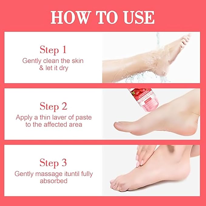 Grospe 42% Urea Cream Moisturizer plus Strawberry for Dry Cracked Feet Knees Elbows Hands Hydrates & Nourish Foot Care for Softens Exfoliates Dead Skin Smoothing Skin, 1.41Oz