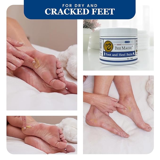 Sweet Bee Naturals Organic Foot Balm - Intensive Heel Balm for Dry Cracked Feet - Natural Moisturizing Treatment for Cracked Heels - Heel Cream Softener for Rough Skin Repair 1 Jar (2 OZ)