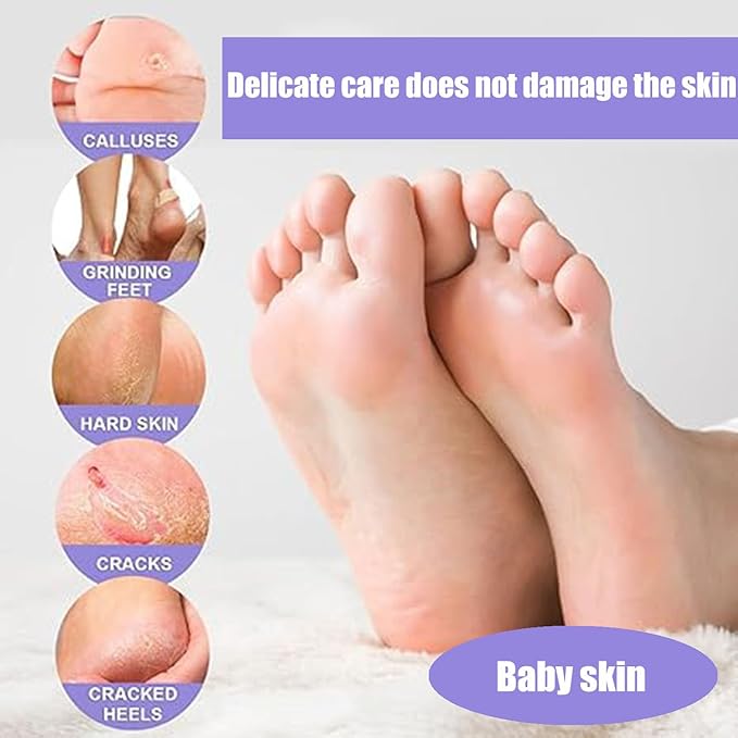 Foot Peel Mask 5 Pack, Exfoliator Peel Off Calluses Dead Skin Callus Remover, Baby Soft Smooth Touch Feet Spa Experience at Home & Gift Ideas - Lavender Scented