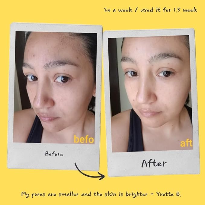 Exfoliating Mask for Face and Body, Brightening Treatment for Dull Skin, Uneven Tone, and Rough Texture (Orange)