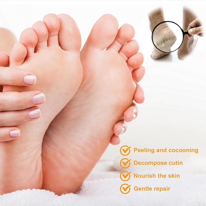 2Packs Foot Cream&Urea Cream 30 Percent for Feet, Foot Cream and Hand Cream Maximum Strength with Hyaluronic Acid, Aloe Vera for Deep Moisturizes, Callus Remover