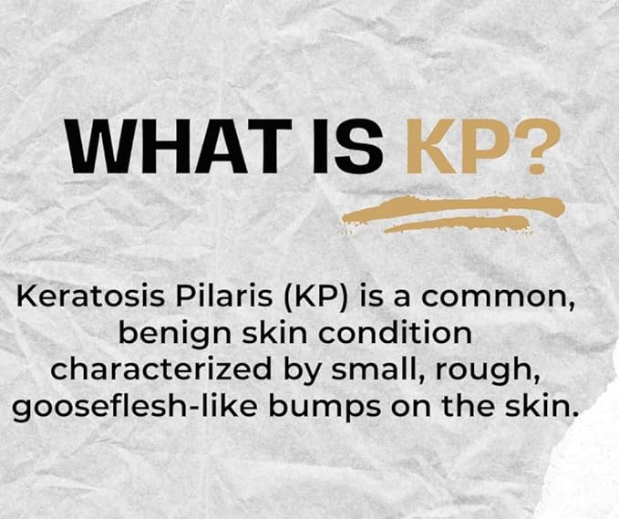 Areton KP Bump Eraser Cream – Exfoliating Treatment for Keratosis Pilaris & Rough Skin with 8 Active Ingredients