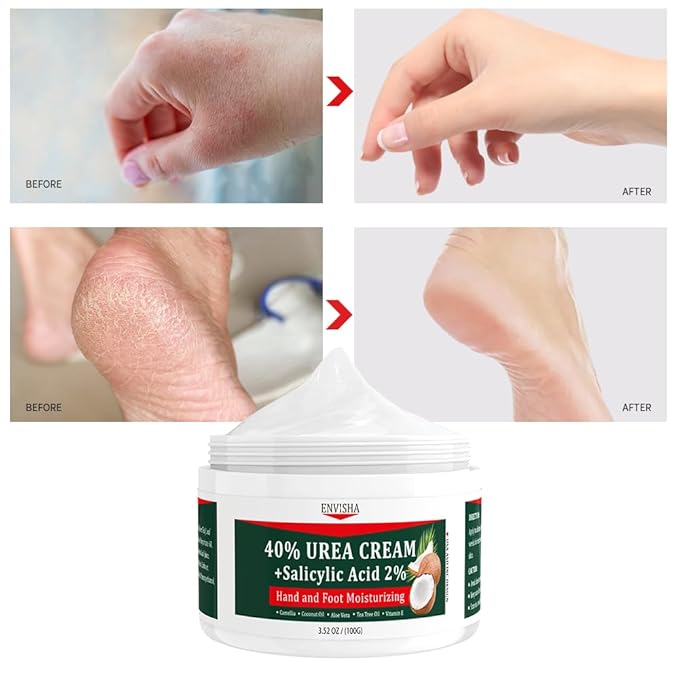 40% Urea Cream for Dry Cracked Feet- Maximum Strength Foot & Hand Moisturizer with 2% Salicylic Acid, Tea Tree, and Aloe Vera | Deep Hydration & Softener for Feet Care