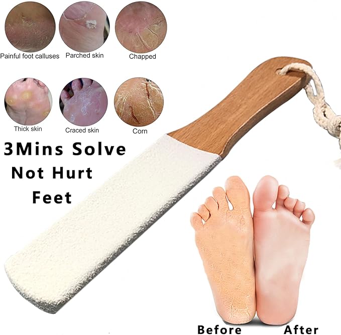 Kinepi Feet Callus Removers Professional Colossal Foot Scrubber Pedicure Foot File Foot Massager Pumice Stone for Feet,Remover Corn Hard Skin Dead Skin Exfoliator for Use in Shower Feet Care Tools