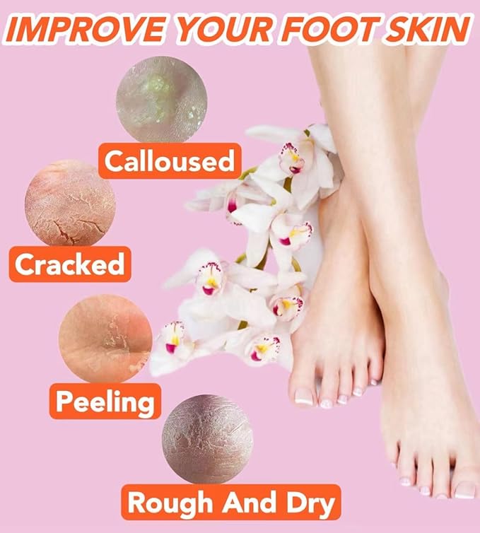 2 Pairs Silicone Socks for Dry Cracked Feet Women,Silicones Moisturizing Socks,Foot Spa Pedicure Silicone Socks for Repairing Dry Feet,Cracked Heels(Beige & Beige, Medium/Large(fits Size 8 to 11))