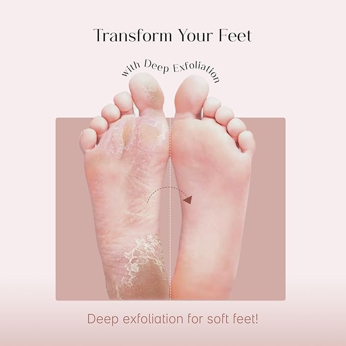 Seoul'Skin Glycoli'c Acid Foot Peel Mask (150,000 PPM) deeply exfoliates, removes dead skin, softens, and hydrates. Vegan, cruelty-free, paraben-free-ideal for all skin types.
