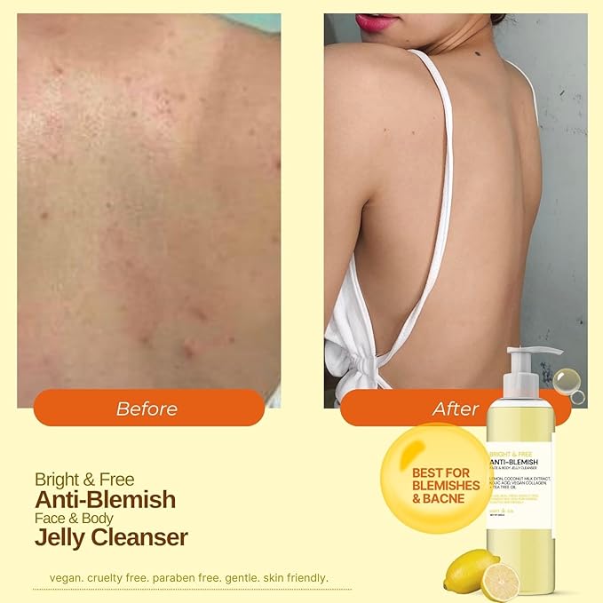 Catt & co. Bright and Free ANTI- BLEMISH FACE & BODY JELLY CLEANSER 250ML
