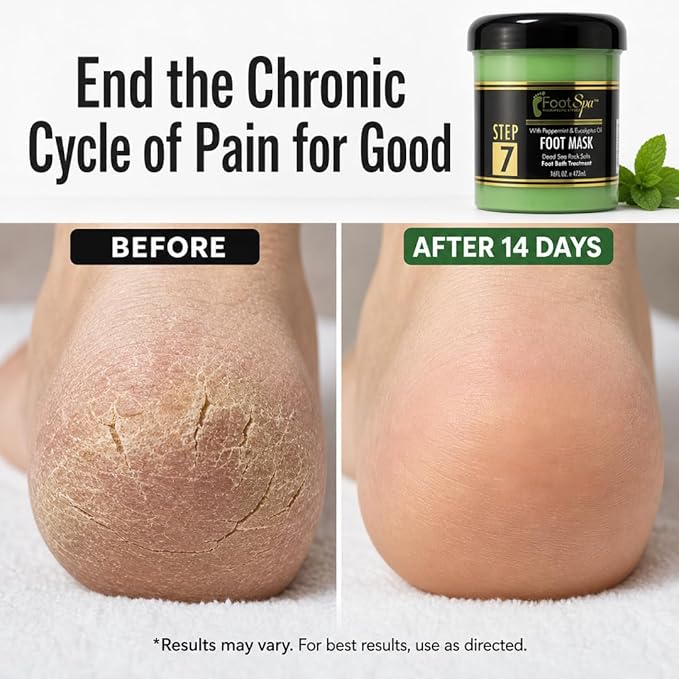Foot Repair Mask - Dual-Action Cosmeceutical Treatment that Regenerates Skin from Within to Heal Painful Fissures and Provide Spa-Quality Cooling Relief - 16 oz