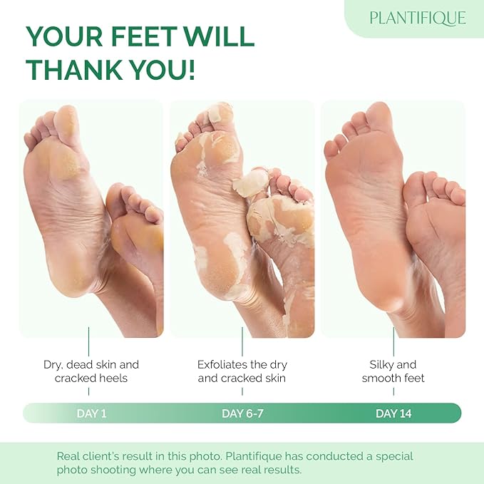 PLANTIFIQUE Foot Peeling Mask - Peeling Foot Mask Dermatologically Tested Repairs Heels & Removes Dry Dead Skin for Baby Soft Feet (Jasmine, 1 Count (Pack of 2))