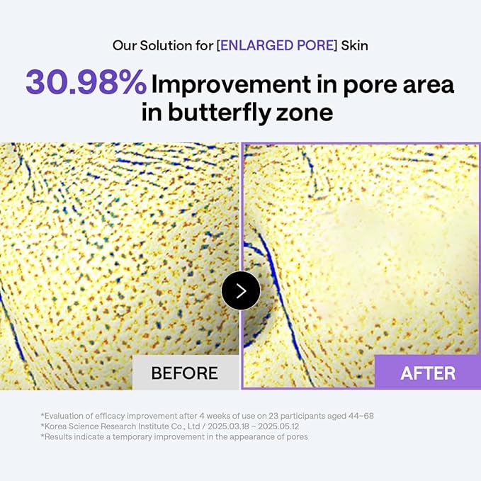 MEDIHEAL Toner Pads 100 Count - PDRN Stretchable Lifting Pads with Squalane and Glutathione for Total Skin Care - Plant Based Rose PDRN - Wrinkle & Pore Care - Vegan Stretchable Lifting Fabric
