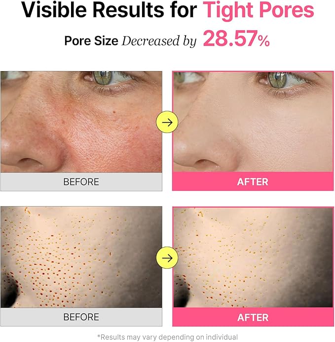 Veganifect Pore Refining Toner Pad for All Skin Types, Sebum Control, Tighten Pores, Korean Skin Care, Vegan (70 Pads)