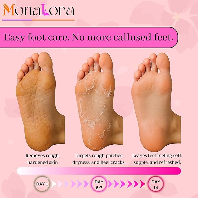 Foot Peel Mask for Dry, Cracked Heels – Exfoliating Callus Remover with Natural Fruit Extracts – Baby Soft Feet in 1 Week – 2 Packs | Lavender Scent