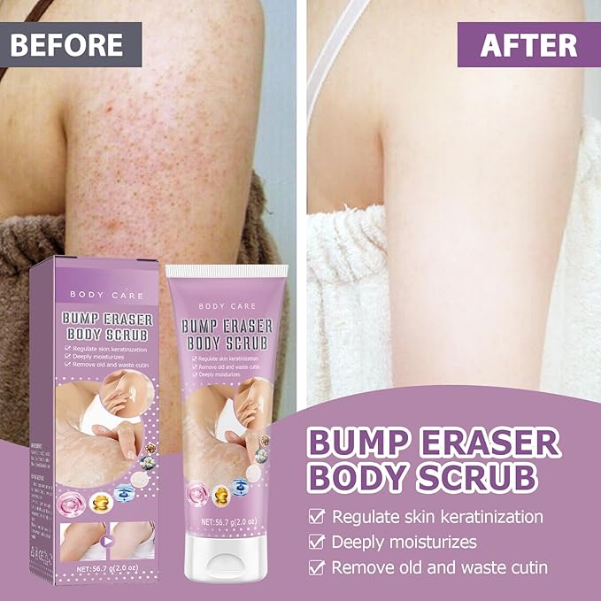 Bump Eraser Body Scrub Exfoliant for Keratosis Pilaris Body Acne Dead Skin Ingrown Hair Razor Bumps and Rough Patches Keratosis Pilaris Treatment Strawberry Legs Treatment for Women
