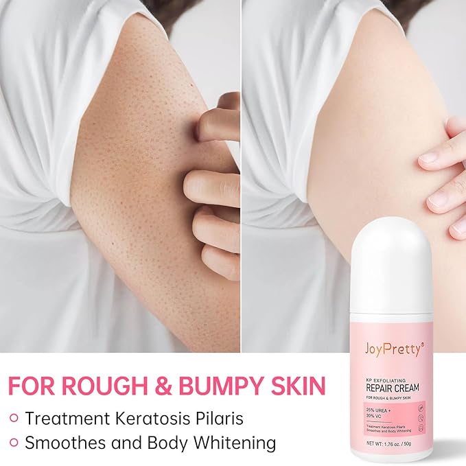 Strawberry Legs Treatment For Women,Bump Eraser Body Scrub, Keratosis Pilaris Treatment,Rough Bumpy Body Cream, Bump Eraser Body Scrub,Smoothing & Buffing Body Scrub Body Care