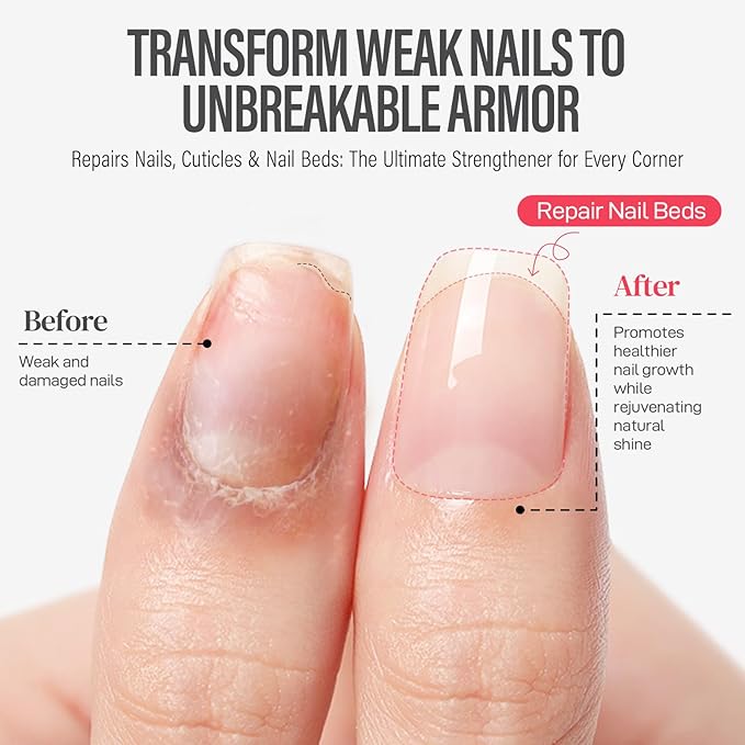 CHUCHU Vegan Cuticle Oil for Nails: Watermelon Jojoba Nail Cuticle Oil with Vitamin B & E for Moisturizes Cuticle and Nail's Skin - Prevents Hangnails and Chapped 15ML