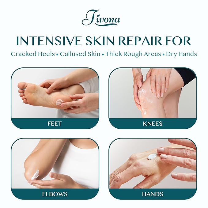 FIVONA 42% Urea Foot Cream for Thick, Rough Dry Skin - Maximum Strength Callus Softening with 2% Salicylic Acid, Tea Tree & Aloe Vera, 100g (3.5 oz) - Deep Moisturizing Foot Care