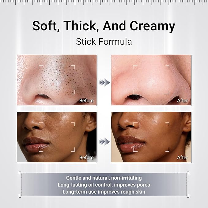 Volcano Clay Stick Mask, Kaolin Charcoal Face Mask for Deep Pore Clean & Oil Control, Blackhead Remover with Ectoin & Aloe, Sensitive Skin Friendly Travel Design, 45g/1.58oz