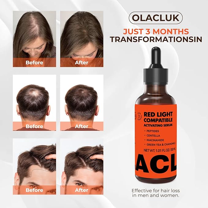 Copper Peptide Hair Growth Serum for Red Light Therapy Cap, Lightweight Scalp Serum for Thinning Hair, Supports Fuller & Stronger Looking Hair, Non-Greasy Formula for Women & Men, 30ML