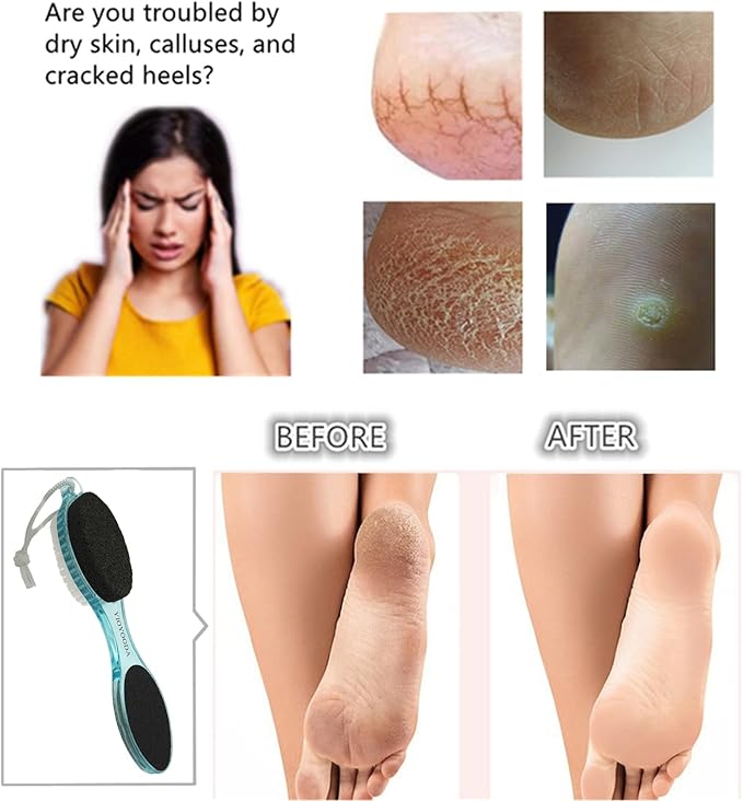 Foot File Callus Remover 4-in-1, 3 Pcs Feet Scraper Pedicure Tools with Pumice Stone, Scrubber Brush, Foot Rasp and Sand Paper, Double Sided Multi Purpose, Clear Pink, Blue, Purple